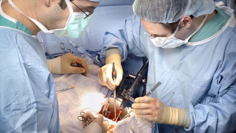 Kidney transplant surgery